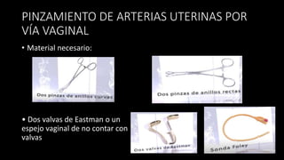 TECNICA DE ZEA.pptx