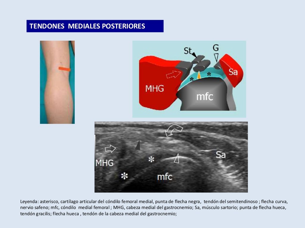 tecnica eco rodilla - instagram mhg twgram