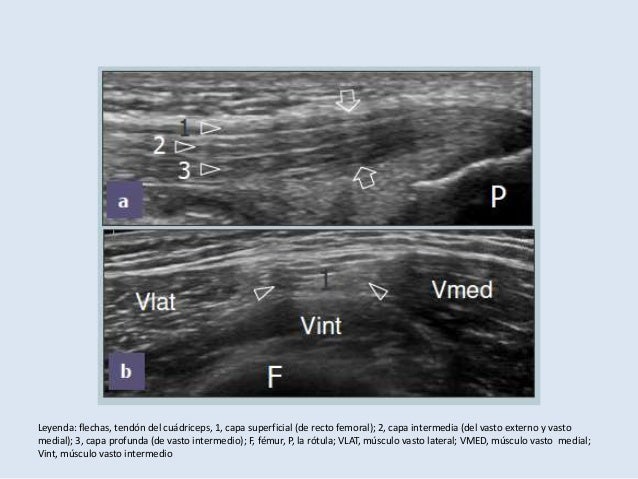 Tecnica eco rodilla Tecnica eco rodilla