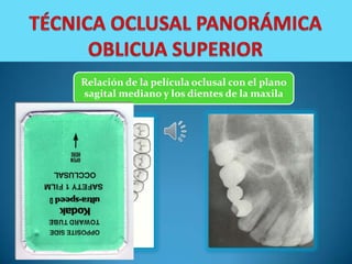 Relación de la película oclusal con el plano
sagital mediano y los dientes de la maxila
 