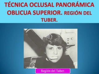 Región del Tuber.
 