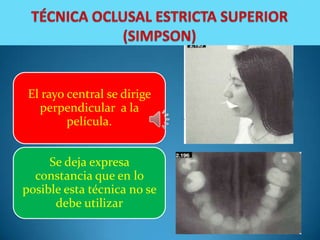 El rayo central se dirige
   perpendicular a la
         película.


     Se deja expresa
  constancia que en lo
posible esta técnica no se
      debe utilizar
 