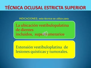 INDICACIONES, esta técnica se utiliza para:

La ubicación vestibulopalatina
de dientes
incluidos, supernumerarios.


Extensión vestibuloplatina de
lesiones quísticas y tumorales.
 