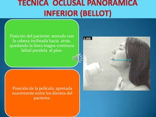 Posición del paciente: sentado con
 la cabeza inclinada hacia atrás,
quedando la línea tragus-comisura
      labial paralela al piso.




 Posición de la película: apretada
 suavemente entre los dientes del
            paciente.
 