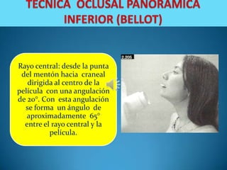Rayo central: desde la punta
 del mentón hacia craneal
   dirigida al centro de la
película con una angulación
de 20°. Con esta angulación
  se forma un ángulo de
   aproximadamente 65°
  entre el rayo central y la
          película.
 