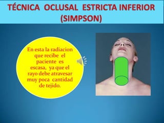 En esta la radiacion
   que recibe el
    paciente es
 escasa, ya que el
rayo debe atravesar
muy poca cantidad
     de tejido.
 