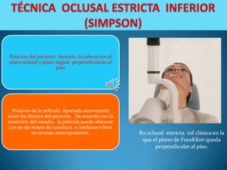 Posición del paciente: Sentado, la cabeza con el
plano oclusal y plano sagital perpendiculares al
                      piso




  Posición de la película: Apretada suavemente
entre los dientes del paciente. De acuerdo con la
intención del estudio, la película puede ubicarse
 con su eje mayor de comisura a comisura o bien
            en sentido anteroposterior.             Rx oclusal estricta inf clásica en la
                                                     que el plano de FranKfort queda
                                                          perpendicular al piso.
 