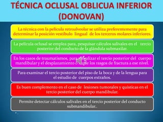 La técnica con la película retroalveolar se utiliza preferentemente para
determinar la posición vestibulo lingual de los terceros molares inferiores.

La película oclusal se emplea para, pesquisar cálculos salivales en el tercio
             posterior del conducto de la glándula submaxilar.

En los casos de traumatismos, para visualizar el tercio posterior del cuerpo
 mandibular y el desplazamiento o no de los rasgos de fractura a ese nivel.

  Para examinar el tercio posterior del piso de la boca y de la lengua para
                      el estudio de cuerpos extraños.

 Es buen complemento en el caso de lesiones tumorales y quísticas en el
               tercio posterior del cuerpo mandibular.

      Permite detectar cálculos salivales en el tercio posterior del conducto
                                 submandibular..
 •.
 