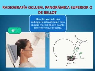Hace las veces de una
radiografía retroalveolar, pero
mucho más amplia en cuanto
  al territorio que muestra.
 