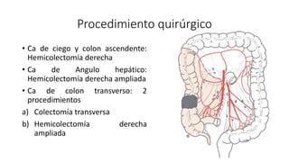 Procedimiento quirúrgico
• Ca de ciego y colon ascendente:
Hemicolectomía derecha
• Ca de Angulo hepático:
Hemicolectomía ...