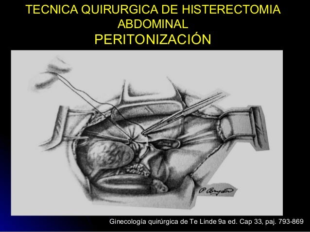 Tecnica quirurgica de histerectomia abdominal