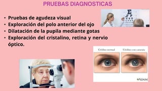 • Pruebas de agudeza visual
• Exploración del polo anterior del ojo
• Dilatación de la pupila mediante gotas
• Exploración del cristalino, retina y nervio
óptico.
 