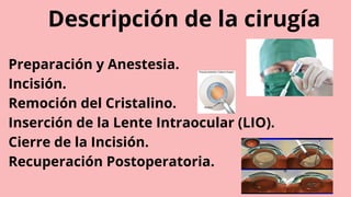 Descripción de la cirugía
Preparación y Anestesia.
Incisión.
Remoción del Cristalino.
Inserción de la Lente Intraocular (LIO).
Cierre de la Incisión.
Recuperación Postoperatoria.
 