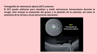 Tomografía de coherencia óptica (OCT) anterior:
El OCT puede utilizarse para visualizar y medir estructuras intraoculares durante la
cirugía. Esto incluye la evaluación del grosor y la posición de la catarata, así como la
anatomía de la córnea y otras estructuras relevantes.
 
