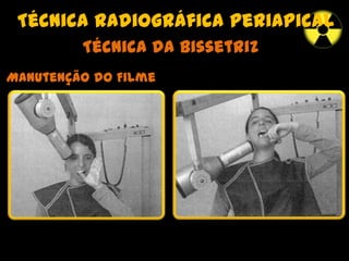 Técnica radiográfica periapical
Técnica da Bissetriz
Manutenção do Filme
 