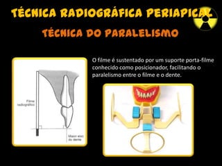 Técnica radiográfica periapical
Técnica do paralelismo
O filme é sustentado por um suporte porta-filme
conhecido como posicionador, facilitando o
paralelismo entre o filme e o dente.
 