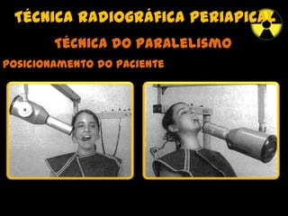 Técnica radiográfica periapical
Técnica do paralelismo
Posicionamento do paciente
 