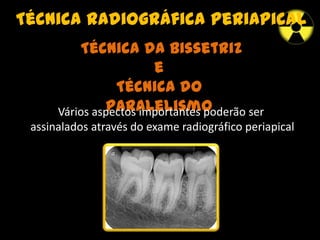 Técnica radiográfica periapical
Técnica da Bissetriz
e
Técnica do
paralelismoVários aspectos importantes poderão ser
assinalados através do exame radiográfico periapical
 