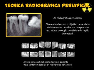 Técnica radiográfica periapical
As Radiografias periapicais:
São realizadas com o objetivo de se obter
de forma mais detalhada a imagem das
estruturas do órgão dentário e da região
periapical.
A ficha periapical da boca toda de um paciente
deve conter um total de 14 radiografias periapicais.
 