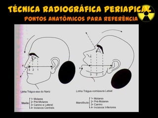 Técnica radiográfica periapical
Pontos anatômicos para referência
 