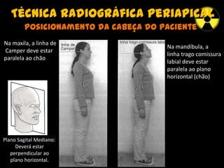 Técnica radiográfica periapical
Posicionamento da cabeça do paciente
Na maxila, a linha de
Camper deve estar
paralela ao chão
Na mandíbula, a
linha trago comissura
labial deve estar
paralela ao plano
horizontal (chão)
Plano Sagital Mediano:
Deverá estar
perpendicular ao
plano horizontal.
 