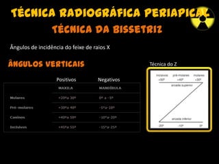 Técnica radiográfica periapical
Técnica da Bissetriz
Ângulos de incidência do feixe de raios X
Ângulos Verticais Técnica do Z
Positivos Negativos
 