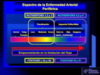 Fontaine Or Rutherford Endovascular Treatment of Critical Limb Ischemia | PPTX