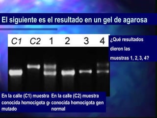 El siguiente es el resultado en un gel de agarosa   En la calle (C1) muestra conocida homocigota   gen mutado En la calle (C2) muestra conocida homocigota   gen normal  ¿Qué resultados  dieron las  muestras 1, 2, 3, 4? 