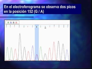 En el electroferograma se observa dos picos en la posición 152 (G / A) 
