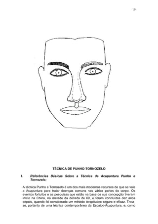 TÉCNICA DE PUNHO-TORNOZELO
I. Referências Básicas Sobre a Técnica de Acupuntura Punho e
Tornozelo:
A técnica Punho e Tornozelo é um dos mais modernos recursos de que se vale
a Acupuntura para tratar doenças comuns nas várias partes do corpo. Os
eventos fortuitos e as pesquisas que estão na base de sua concepção tiveram
início na China, na metade da década de 60, e foram concluídas dez anos
depois, quando foi considerada um método terapêutico seguro e eficaz. Trata-
se, portanto de uma técnica contemporânea da Escalpo-Acupuntura, e, como
19
 