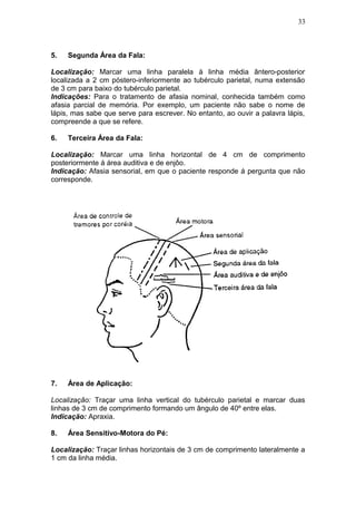 5. Segunda Área da Fala:
Localização: Marcar uma linha paralela à linha média ântero-posterior
localizada a 2 cm póstero-inferiormente ao tubérculo parietal, numa extensão
de 3 cm para baixo do tubérculo parietal.
Indicações: Para o tratamento de afasia nominal, conhecida também como
afasia parcial de memória. Por exemplo, um paciente não sabe o nome de
lápis, mas sabe que serve para escrever. No entanto, ao ouvir a palavra lápis,
compreende a que se refere.
6. Terceira Área da Fala:
Localização: Marcar uma linha horizontal de 4 cm de comprimento
posteriormente á área auditiva e de enjôo.
Indicação: Afasia sensorial, em que o paciente responde á pergunta que não
corresponde.
7. Área de Aplicação:
Localização: Traçar uma linha vertical do tubérculo parietal e marcar duas
linhas de 3 cm de comprimento formando um ângulo de 40º entre elas.
Indicação: Apraxia.
8. Área Sensitivo-Motora do Pé:
Localização: Traçar linhas horizontais de 3 cm de comprimento lateralmente a
1 cm da linha média.
33
 