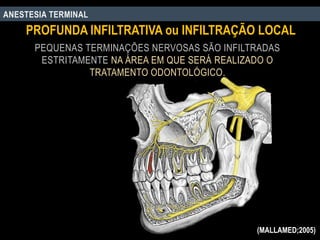 PEQUENAS TERMINAÇÕES NERVOSAS SÃO INFILTRADAS
ESTRITAMENTE NA ÁREA EM QUE SERÁ REALIZADO O
TRATAMENTO ODONTOLÓGICO.
PROFUNDA INFILTRATIVA ou INFILTRAÇÃO LOCAL
ANESTESIA TERMINAL
(MALLAMED;2005)
 