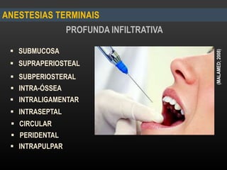ANESTESIAS TERMINAIS
PROFUNDA INFILTRATIVA
 SUPRAPERIOSTEAL
 SUBPERIOSTERAL
 SUBMUCOSA
 INTRASEPTAL
 INTRALIGAMENTAR
 PERIDENTAL
 CIRCULAR
 INTRAPULPAR
 INTRA-ÓSSEA
(MALAMED;2008)
 