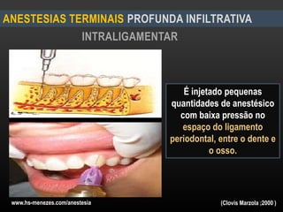 INTRALIGAMENTAR
ANESTESIAS TERMINAIS PROFUNDA INFILTRATIVA
www.hs-menezes.com/anestesia
É injetado pequenas
quantidades de anestésico
com baixa pressão no
espaço do ligamento
periodontal, entre o dente e
o osso.
(Clovis Marzola ;2000 )
 