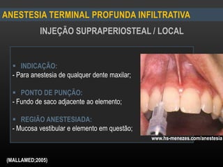 ANESTESIA TERMINAL PROFUNDA INFILTRATIVA
INJEÇÃO SUPRAPERIOSTEAL / LOCAL
 INDICAÇÃO:
- Para anestesia de qualquer dente maxilar;
 PONTO DE PUNÇÃO:
- Fundo de saco adjacente ao elemento;
 REGIÃO ANESTESIADA:
- Mucosa vestibular e elemento em questão;
www.hs-menezes.com/anestesia
(MALLAMED;2005)
 