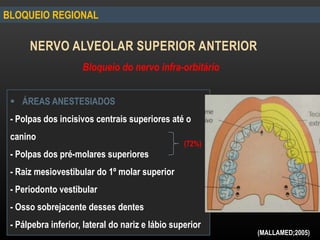BLOQUEIO REGIONAL
NERVO ALVEOLAR SUPERIOR ANTERIOR
Bloqueio do nervo infra-orbitário
 ÁREAS ANESTESIADOS
- Polpas dos incisivos centrais superiores até o
canino
- Polpas dos pré-molares superiores
- Raiz mesiovestibular do 1º molar superior
- Periodonto vestibular
- Osso sobrejacente desses dentes
- Pálpebra inferior, lateral do nariz e lábio superior
(MALLAMED;2005)
(72%)
 