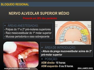 BLOQUEIO REGIONAL
NERVO ALVEOLAR SUPERIOR MÉDIO
Presente em 28% dos pacientes
 ÁREAS ANESTESIADAS:
- Polpas do 1º e 2º pré-molares superiores
- Raíz mesiovestibular do 1º molar superior
- Mucosa periodonta e osso sobrejacente
 ÁREA DE INTRODUÇÃO:
- Altura da prega mucovestibular acima do 2º
pré-molar superior
 POSIÇÃO:
ASM direito- 10 horas
ASM esquerdo- 8 ou 9 horas.
www.portaodaeducacao.com.br (MALLAMED;2005)
 
