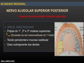 NERVO ALVEOLAR SUPERIOR POSTERIOR
BLOQUEIO REGIONAL
 ÁREAS ANESTESIADAS
- Polpas do 1°, 2º e 3º molares superiores.
(Excessão da raiz mesiovestibular do 1°molar)
- Tecido periodontal e mucosa vestibular
- Osso subrejacente dos dentes
Bloqueio da tuberosidade, bloqueio zigomático.
(MALLAMED;2005)
 