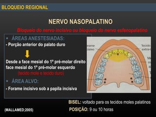 BLOQUEIO REGIONAL
NERVO NASOPALATINO
Bloqueio do nervo incisivo ou bloqueio do nervo esfenopalatino
 ÁREAS ANESTESIADAS:
- Porção anterior do palato duro
Desde a face mesial do 1º pré-molar direito a
face mesial do 1º pré-molar esquerdo
(tecido mole e tecido duro)
 ÁREA ALVO:
- Forame incisivo sob a papila incisiva
BISEL: voltado para os tecidos moles palatinos
POSIÇÃO: 9 ou 10 horas(MALLAMED;2005)
 