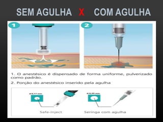 SEM AGULHA X COM AGULHA
 