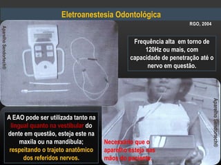 Eletroanestesia Odontológica
AparelhoSendortech®
Frequência alta em torno de
120Hz ou mais, com
capacidade de penetração até o
nervo em questão.
A EAO pode ser utilizada tanto na
lingual quanto na vestibular do
dente em questão, esteja este na
maxila ou na mandíbula;
respeitando o trajeto anatômico
dos referidos nervos.
Necessário que o
aparelho esteja nas
mãos do paciente.
RGO, 2004
AparelhoSendortech®
 