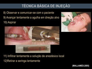 8) Observar e comunicar-se com o paciente
9) Avançar lentamente a agulha em direção alvo
10) Aspirar
11) Infiltrar lentamente a solução de anestésico local
12)Retirar a seringa lentamente
TÉCNICA BÁSICA DE INJEÇÃO
(MALLAMED;2005)
 