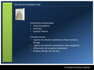 Técnicas de Anestesia Local




                Estructuras anestesiadas
                • Mucosa palatina.
                • Periostio.
                • Cortical interna.

                Complicaciones:
                • Ingreso de solución anestésica a fosas nasales y
                  faringe.
                • Ingreso de solución anestésica a vaso sanguíneo.
                • Inflamación de la papila interdental.
                • Posibles efectos de necrosis.




                                                  CD MARCOS NOVOA HERRERA
 