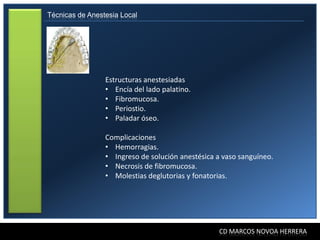 Técnicas de Anestesia Local




                 Estructuras anestesiadas
                 • Encía del lado palatino.
                 • Fibromucosa.
                 • Periostio.
                 • Paladar óseo.

                 Complicaciones
                 • Hemorragias.
                 • Ingreso de solución anestésica a vaso sanguíneo.
                 • Necrosis de fibromucosa.
                 • Molestias deglutorias y fonatorias.




                                                  CD MARCOS NOVOA HERRERA
 