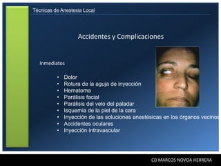 Técnicas de Anestesia Local




                   Accidentes y Complicaciones


   Inmediatos

          •   Dolor
          •   Rotura de la aguja de inyección
          •   Hematoma
          •   Parálisis facial
          •   Parálisis del velo del paladar
          •   Isquemia de la piel de la cara
          •   Inyección de las soluciones anestésicas en los órganos vecinos
          •   Accidentes oculares
          •   Inyección intravascular




                                                CD MARCOS NOVOA HERRERA
 