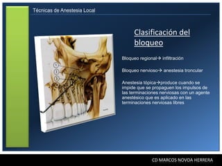 Técnicas de Anestesia Local



                                   Clasificación del
                                   bloqueo
                              Bloqueo regional infiltración

                              Bloqueo nervioso anestesia troncular

                              Anestesia tópicaproduce cuando se
                              impide que se propaguen los impulsos de
                              las terminaciones nerviosas con un agente
                              anestésico que es aplicado en las
                              terminaciones nerviosas libres




                                            CD MARCOS NOVOA HERRERA
 