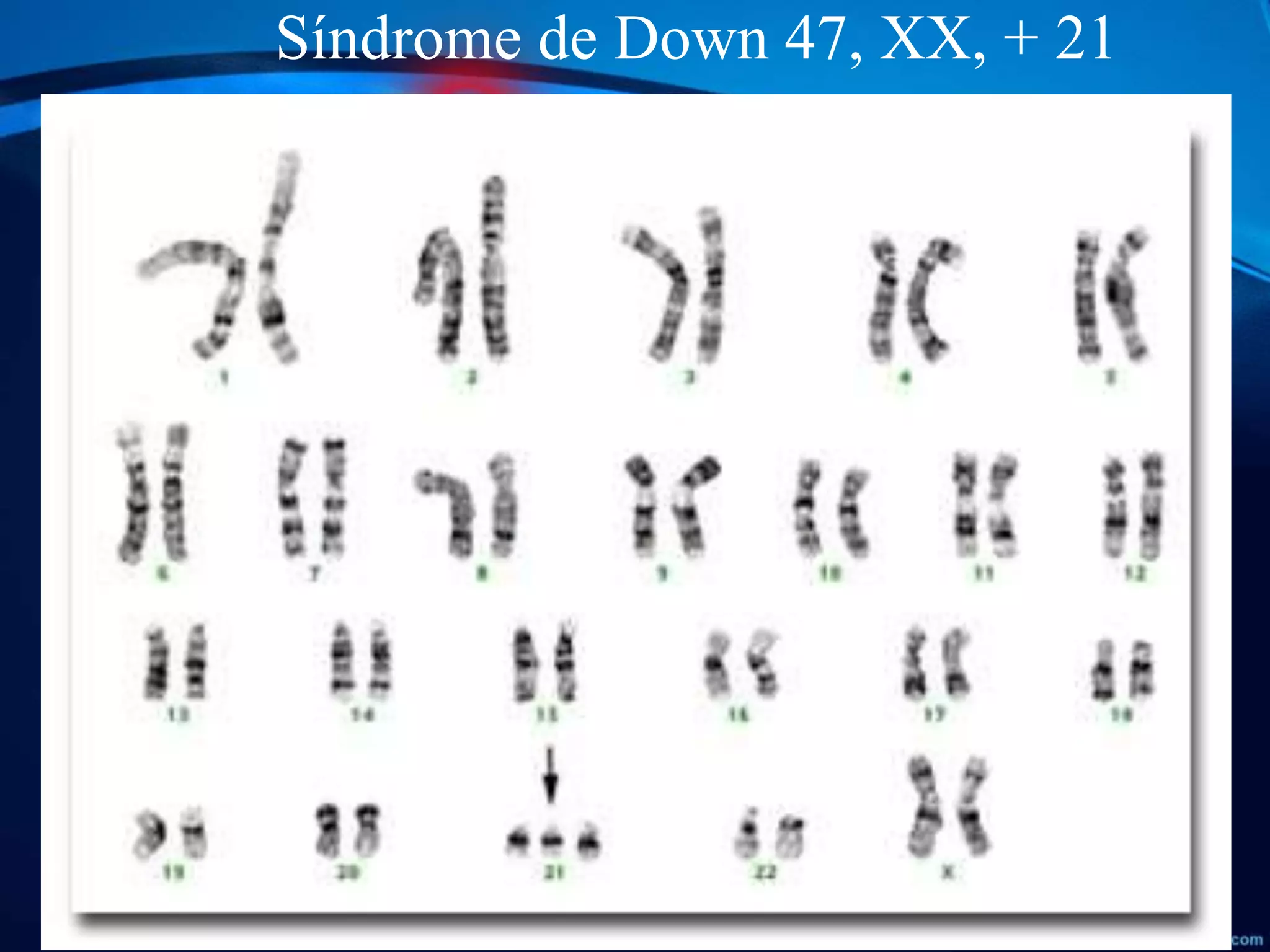 Tecnicas de Bandeo Cromosomico | PPTX