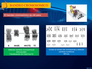 Tecnicas de Bandeo Cromosomico