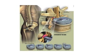 Comprehensive Overview of Postural Correction Methods: Williams ...