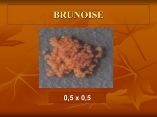 BRUNOISE
0,5 x 0,5
 